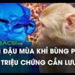 NHỮNG ĐIỀU CẦN BIẾT VỀ BỆNH ĐẬU MÙA KHỈ