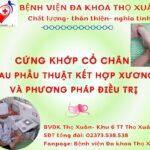 PHỤC HỒI CHỨC NĂNG CỨNG KHỚP CỔ CHÂN SAU PHẪU THUẬT