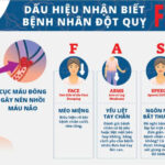 gen-n-đột quỵ