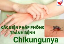 BỘ Y TẾ KHUYẾN CÁO CÁC BIỆN PHÁP PHÒNG CHỐNG DỊCH BỆNH CHIKUNGUNYA